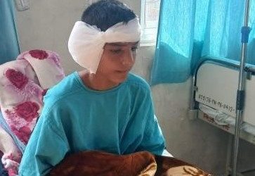 Intervention chirurgicale de JAWAN( 02/26)